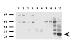 CD20 (MS4A1) Mouse anti-Human, Clone: UMAB58, liquid, UltraMAB 100 &mu;L;