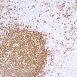 CD20 Mouse anti-Human, Clone: L26, Bethyl Laboratories 100 &mu;L; Unconjugated:Antibodies,