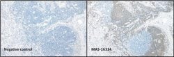 Invitrogen CD20 Monoclonal Antibody (SP32) 500 &mu;L; Unconjugated:Antibodies,