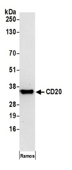 CD20 Mouse anti-Human, Clone: L26, Bethyl Laboratories 100 &mu;L; Unconjugated:Antibodies,