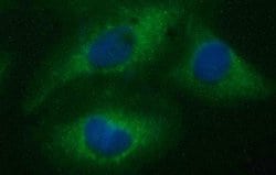 CD22 Mouse anti-Canine, Human, Mouse, Rat, Clone: OTI1F12, lyophilized,