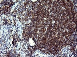 CD22 Monoclonal Antibody (OTI1F2), TrueMAB , OriGene 100 &mu;L; Unconjugated:Antibodies,