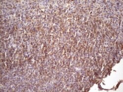 CD22 Mouse anti-Human, Clone: OTI2E6, lyophilized, TrueMAB 100 &mu;g; Unconjugated:Antibodies,
