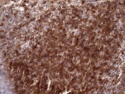 CD22 Mouse anti-Human, Clone: OTI1E6, lyophilized, TrueMAB 100 &mu;g; Unconjugated:Antibodies,
