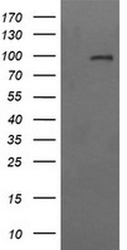 CD22 Monoclonal Antibody (OTI1F2), TrueMAB , OriGene 100 &mu;L; Unconjugated:Antibodies,