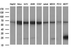 CD22 Mouse anti-Canine, Human, Mouse, Rat, Clone: OTI1F12, lyophilized,