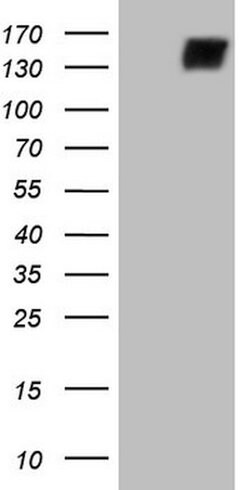 CD22 Mouse anti-Human, Clone: OTI2E6, lyophilized, TrueMAB 100 &mu;g; Unconjugated:Antibodies,