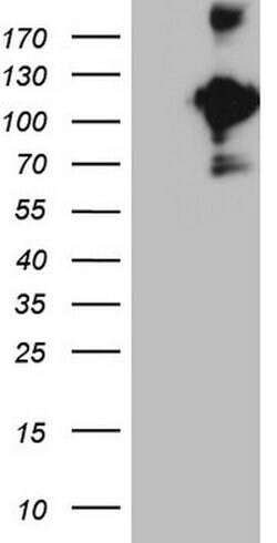CD22 Mouse anti-Human, Clone: OTI1E6, lyophilized, TrueMAB 100 &mu;g; Unconjugated:Antibodies,