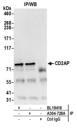 CD2AP Rabbit anti-Human, Polyclonal, Bethyl Laboratories 100 &mu;l; Unlabeled:Antibodies,
