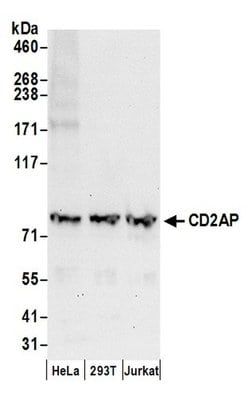 CD2AP Rabbit anti-Human, Polyclonal, Bethyl Laboratories 100 &mu;l; Unlabeled:Antibodies,