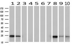 CD3 Mouse anti-Human, Clone: UMAB54, lyophilized, UltraMAB 100 &mu;g; Unconjugated:Antibodies,