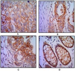 Invitrogen EpCAM Monoclonal Antibody (7E11) 100 &mu;L; Unconjugated:Antibodies,