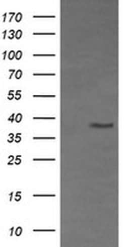 CD33 Monoclonal Antibody (OTI1B10), TrueMAB , OriGene 100 &mu;L; Unconjugated:Antibodies,