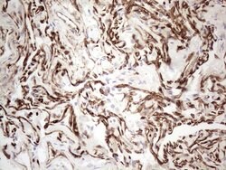 CD34 Mouse anti-Human, Clone: OTI11E1, lyophilized, TrueMAB 100 &mu;g;