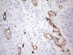 CD34 Monoclonal Antibody (OTI11A5), TrueMAB , OriGene 100 &mu;L; Unconjugated:Antibodies,