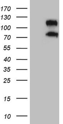 CD34 Mouse anti-Human, Clone: OTI11E1, lyophilized, TrueMAB 100 &mu;g;