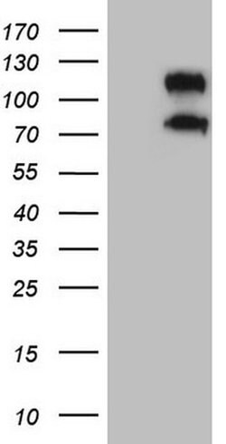 CD34 Mouse anti-Human, Clone: OTI11E1, liquid, TrueMAB 100 μL; Unconjugated:Antibodies,