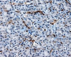 CD36 Monoclonal Antibody (OTI6A5), TrueMAB , OriGene 30 &mu;L; Unconjugated:Antibodies,