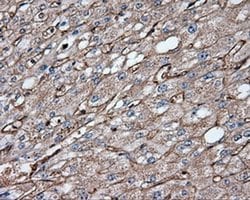 CD36 Monoclonal Antibody (OTI6A5), TrueMAB , OriGene 30 &mu;L; Unconjugated:Antibodies,