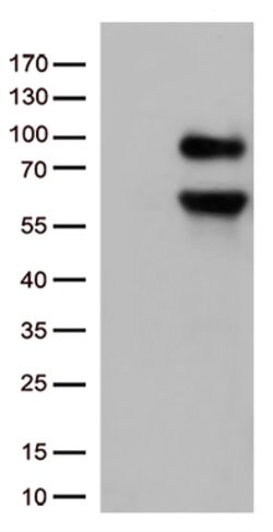 CD36 Mouse anti-Human, Clone: OTI4H7, lyophilized, TrueMAB 100 &mu;g; Unconjugated:Antibodies,