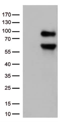 CD36 Monoclonal Antibody (OTI4H7), TrueMAB , OriGene 100 &mu;L; Unconjugated:Antibodies,