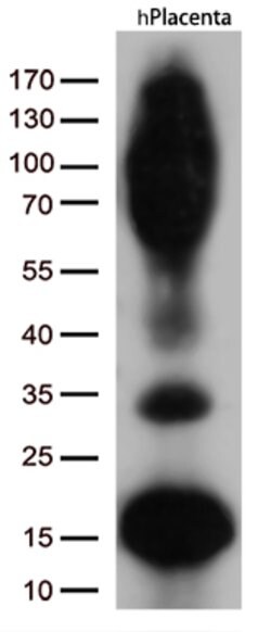 CD36 Mouse anti-Human, Clone: OTI4H7, lyophilized, TrueMAB 100 &mu;g; Unconjugated:Antibodies,