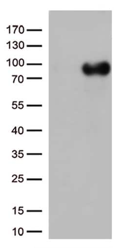 CD36 Monoclonal Antibody (OTI6A5), TrueMAB , OriGene 30 &mu;L; Unconjugated:Antibodies,