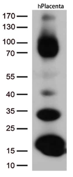 CD36 Monoclonal Antibody (OTI6A5), TrueMAB , OriGene 30 &mu;L; Unconjugated:Antibodies,