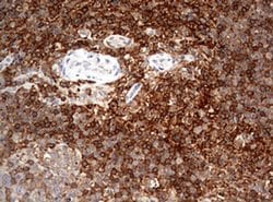 CD4 Monoclonal Antibody (OTI1D6), TrueMAB , OriGene:Antibodies:Primary