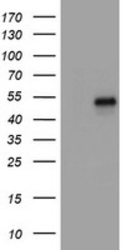 CD4 Mouse anti-Human, Clone: OTI2D4, lyophilized, TrueMAB 100 &mu;g; Unconjugated:Antibodies,