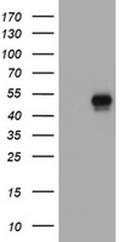 CD4 Monoclonal Antibody (OTI3D2), TrueMAB , OriGene:Antibodies:Primary