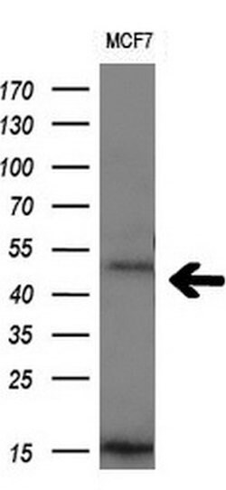 CD4 Monoclonal Antibody (OTI12C8), TrueMAB , OriGene 100 &mu;L; Unconjugated:Antibodies,