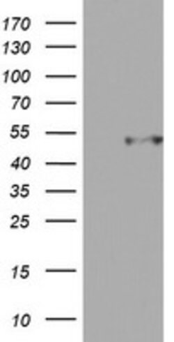 CD4 Mouse anti-Human, Clone: OTI4C6, lyophilized, TrueMAB 100 &mu;g; Unconjugated:Antibodies,
