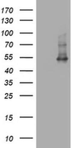 CD4 Monoclonal Antibody (OTI3E11), TrueMAB , OriGene 100 &mu;L; Unconjugated:Antibodies,