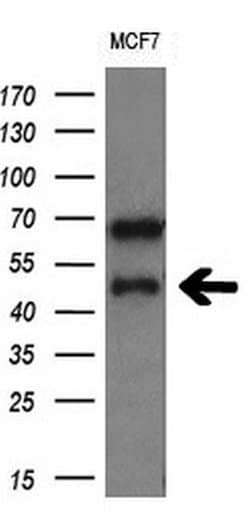 CD4 Monoclonal Antibody (OTI1D6), TrueMAB , OriGene 100 &mu;L; Unconjugated:Antibodies,