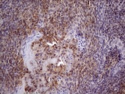 CD40 Monoclonal Antibody (OTI8G5), TrueMAB , OriGene:Antibodies:Primary