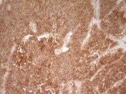 CD40 Monoclonal Antibody (OTI1F12), TrueMAB , OriGene 100 &mu;L; Unconjugated:Antibodies,