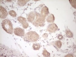 CD40 Monoclonal Antibody (OTI9D8), TrueMAB , OriGene 100 &mu;L; Unconjugated:Antibodies,