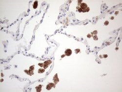 CD40 Mouse anti-Human, Clone: UMAB183, liquid, UltraMAB 100 &mu;L; Unconjugated:Antibodies,