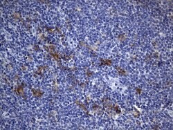 CD40 Mouse anti-Human, Clone: UMAB255, lyophilized, UltraMAB 100 &mu;g;