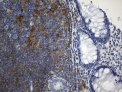 CD40 Mouse anti-Human, Clone: UMAB255, lyophilized, UltraMAB 100 &mu;g;