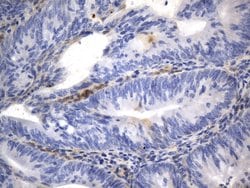 CD40 Mouse anti-Human, Clone: UMAB255, lyophilized, UltraMAB 100 &mu;g;