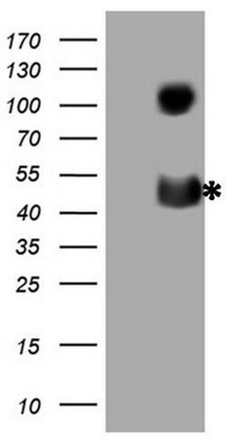 CD40 Monoclonal Antibody (OTI8G5), TrueMAB , OriGene:Antibodies:Primary