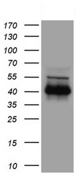 CD40 Mouse anti-Human, Clone: UMAB255, liquid, UltraMAB 100 &mu;L; Unconjugated:Antibodies,
