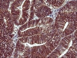 CD44 Monoclonal Antibody (OTI1D8), TrueMAB , OriGene:Antibodies:Primary
