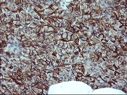 CD44 Monoclonal Antibody (OTI1C8), TrueMAB , OriGene 100 &mu;L; Unconjugated:Antibodies,
