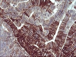 CD44 Monoclonal Antibody (OTI1G1), TrueMAB , OriGene 100 &mu;L; Unconjugated:Antibodies,