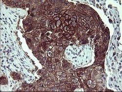 CD44 Monoclonal Antibody (OTI5B5), TrueMAB , OriGene 100 &mu;L; Unconjugated:Antibodies,
