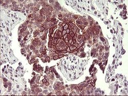 CD44 Monoclonal Antibody (OTI2E3), TrueMAB , OriGene:Antibodies:Primary