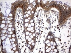 CD44 Mouse anti-Human, Clone: UMAB133, liquid, UltraMAB 30 &mu;L; Unconjugated:Antibodies,